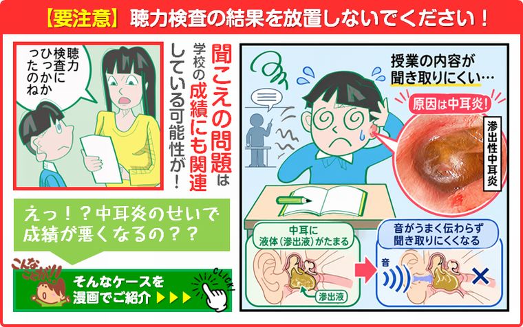 【要注意】聴力検査の結果