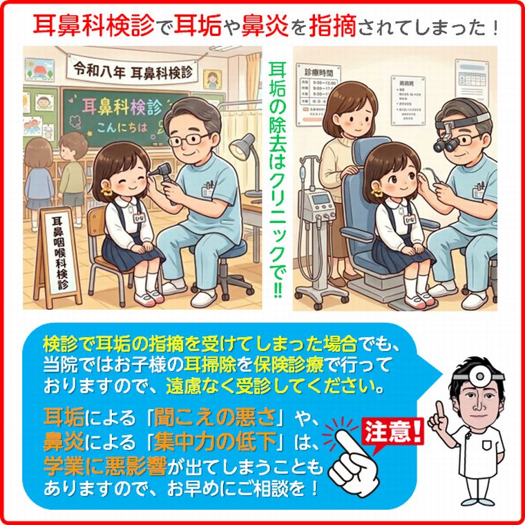 耳鼻科検診で耳垢を指摘されてしまったら